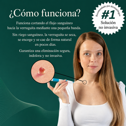 Kit DermoTag - Elimina Verrugas y Marcas en la piel